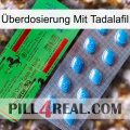 Überdosierung Mit Tadalafil new03